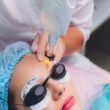 Altes Permanent Make-up Laser entfernung