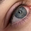 Wimpernkranzverdichtung m/o Pfeil
