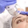 franktionierte Radiofrequenz Microneedling Gesicht / Achselbereich (MORPHEUS8)