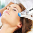 3-er Abo Doppelkinn / SkinBooster Mesotherapie