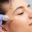 Microneedling /Nanoneedling Glow Premium mit Schafplazenta oder Lachs DNA Serum