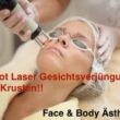 Erbium Laser / Infrarot Laser Gesichtsverjüngung